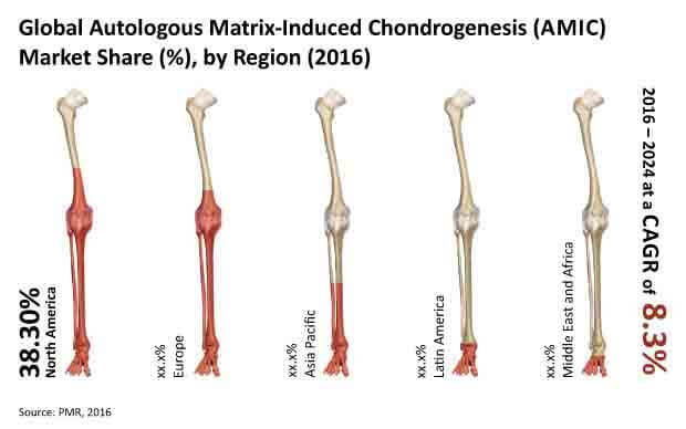 autologous-matrix-induced-chondrogenesis-market.jpg (620×388)