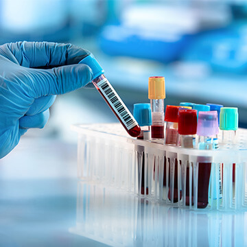 Covid19 Pandemic Amplifies Growth Opportunities In The Emergent Diagnostic Market Says Pmr Covid19 Pandemic Amplifies Growth Opportunities In The Emergent Diagnostic Market Says Pmr