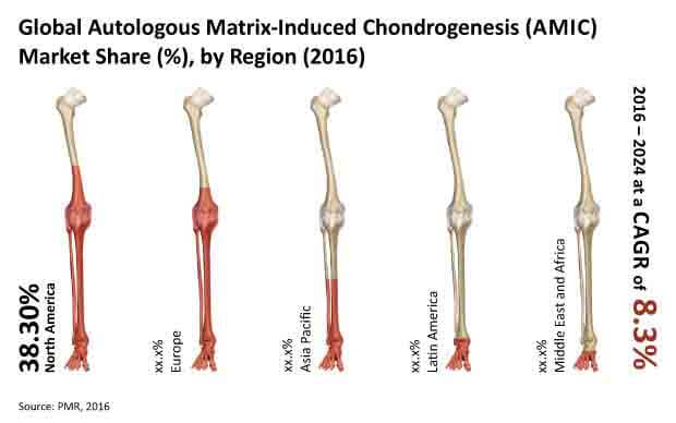 autologous matrix induced chondrogenesis market