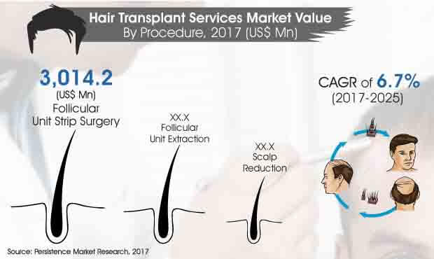 hair transplant services market