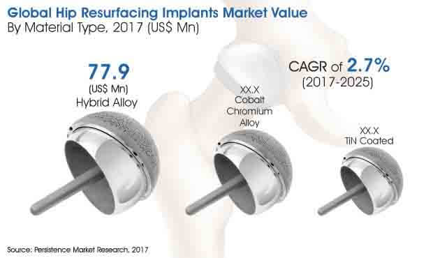 hip resurfacing implants market