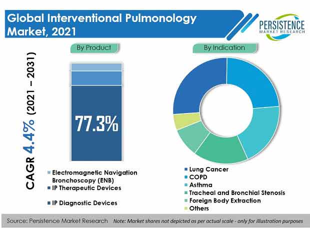 interventional-pulmonology-market.jpg (620×456)