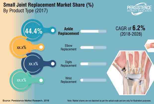 small-joint-replacement-market.jpg (620×420)